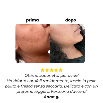 Non è solo sapone. È la svolta per la tua pelle | 1 + 1 Gratis